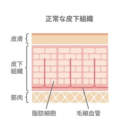 高周波による脂肪分解！